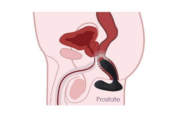 Stimulace prostaty
