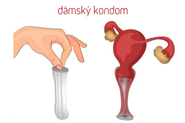 Dámský kondom